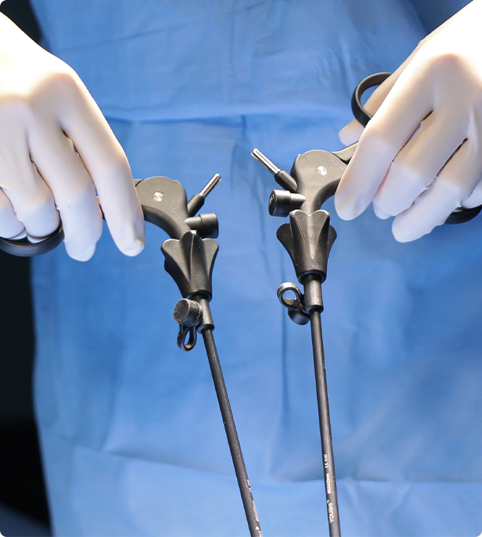 단일통로 복강경 담낭절제술